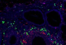 Immunomodulatory signal presentation via synthetic hydrogel material promotes generation of T regulatory cells (green) in the local graft microenvironment (CD3+ T cells in red, and nuclei staining in blue) after implantation into a clinically relevant transplant model for the treatment of type 1 diabetes. (Credit: Georgia Tech)