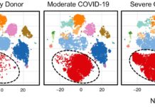 Diagram showing levels of neutrophil immune cells (red dots) in a healthy donor, a patient with moderate COVID-19 and a patient with severe COVID-19. Data analysis by Corey T. Watson, Ph.D., David Tieri, Ph.D., and M.D./Ph.D. student Anne Geller.